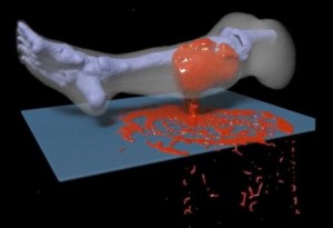 Office of Naval Research-sponsored researchers at the University of California Los Angeles (UCLA) have designed the first detailed computer simulation model of how an injured human leg bleeds.